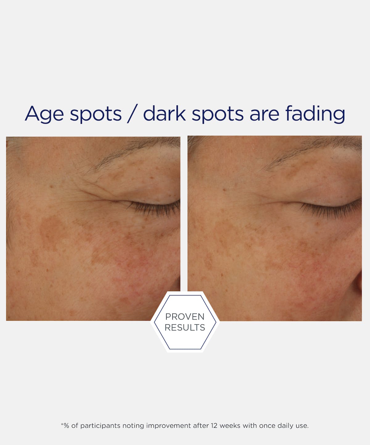 neostrata-potent-retinol-complex