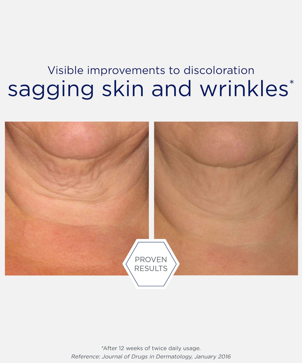 neostrata-triple-firming-neck-cream